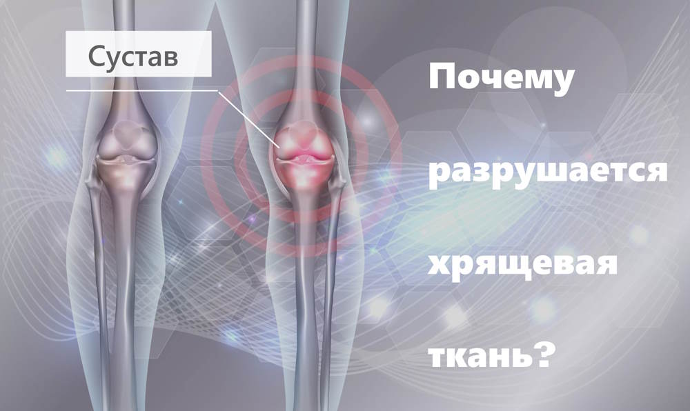 Хрящевая ткань